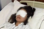 宣威游客在景区遭水枪射伤眼，知情人：水枪购自景区，警方将鉴定